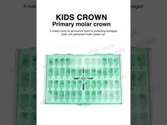 자세히 살펴보기: KIDS CROWN 유구치관