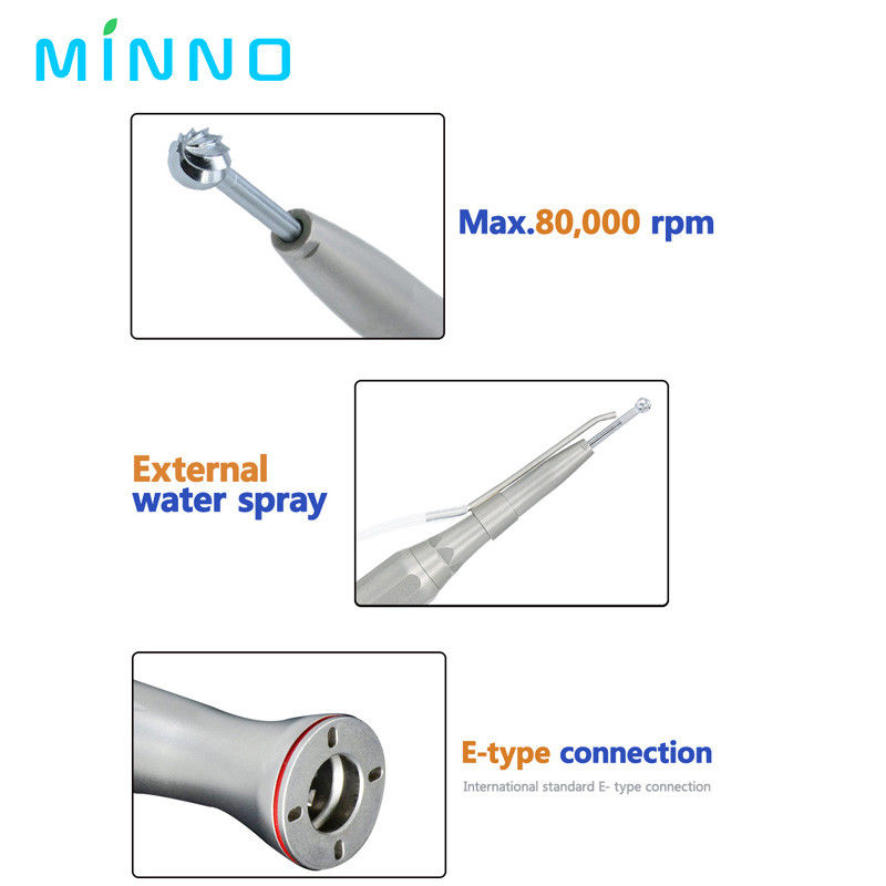 SS 반대 각 수술 손대 0.3Mpa-0.4Mpa E형 손대